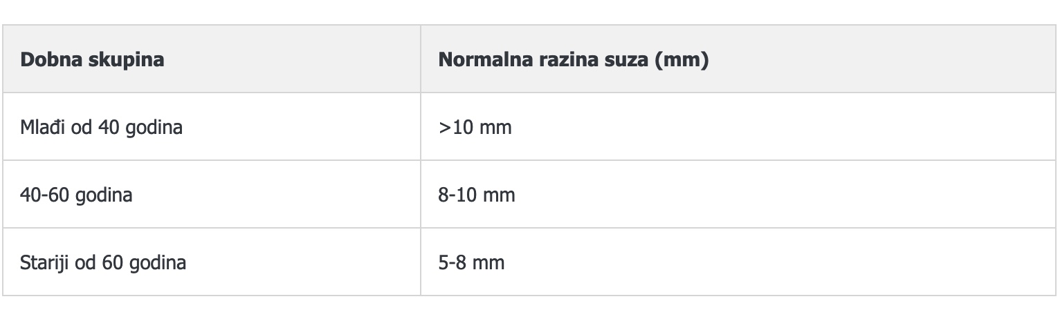 schirmer test